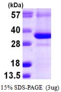 Human CTDSP1 / SCP1 Protein (Recombinant His)