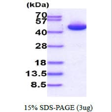 Human PGK1 / Phosphoglycerate Kinase Protein (Recombinant His)