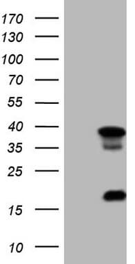 LGALS9 / Galectin 9 Antibody (clone OTI1G3, Carrier-free)