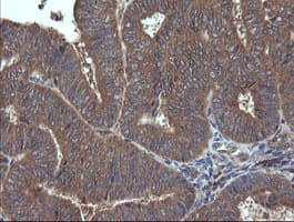 TCL / RHOJ Antibody (clone OTI1C8)