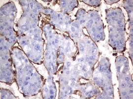 Vimentin Antibody (clone OTI1A9)