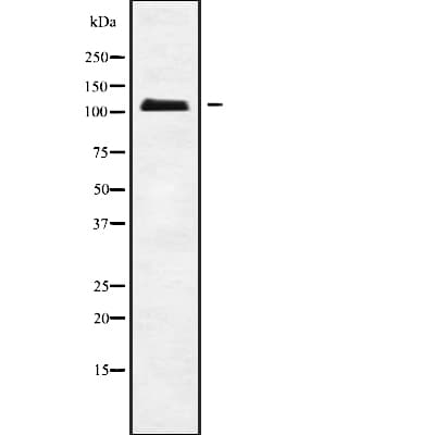 Polyclonal Rabbit anti-Human APOBR / APOB48R Antibody (WB)