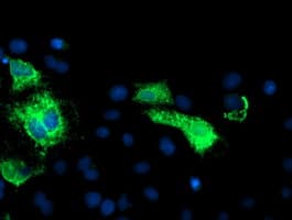 Monoclonal Mouse anti-Human CPA1 / Carboxypeptidase A Antibody (clone OTI2E3, IHC, IF, WB)