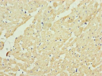 QCR2 / UQCRC2 Antibody