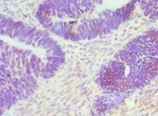 CTCF Antibody (aa1-260)
