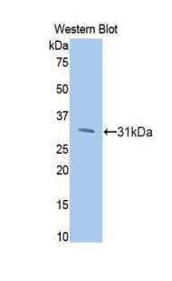 PIK3CB / PI3K Beta Antibody (aa807-1070)