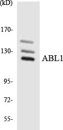 ABL1 / c-ABL Antibody (aa834-883)