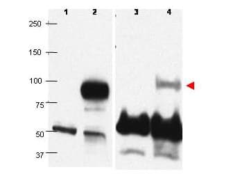 Polyclonal Rabbit anti-Human BLIMP1 / PRDM1 Antibody (C-Terminus, IHC, WB)