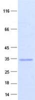 Human C1QTNF5 / CTRP5 Protein (Recombinant Myc-DDK (Flag), C-terminus)