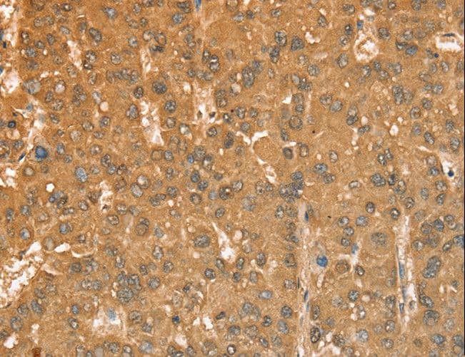 CXCR4 Antibody