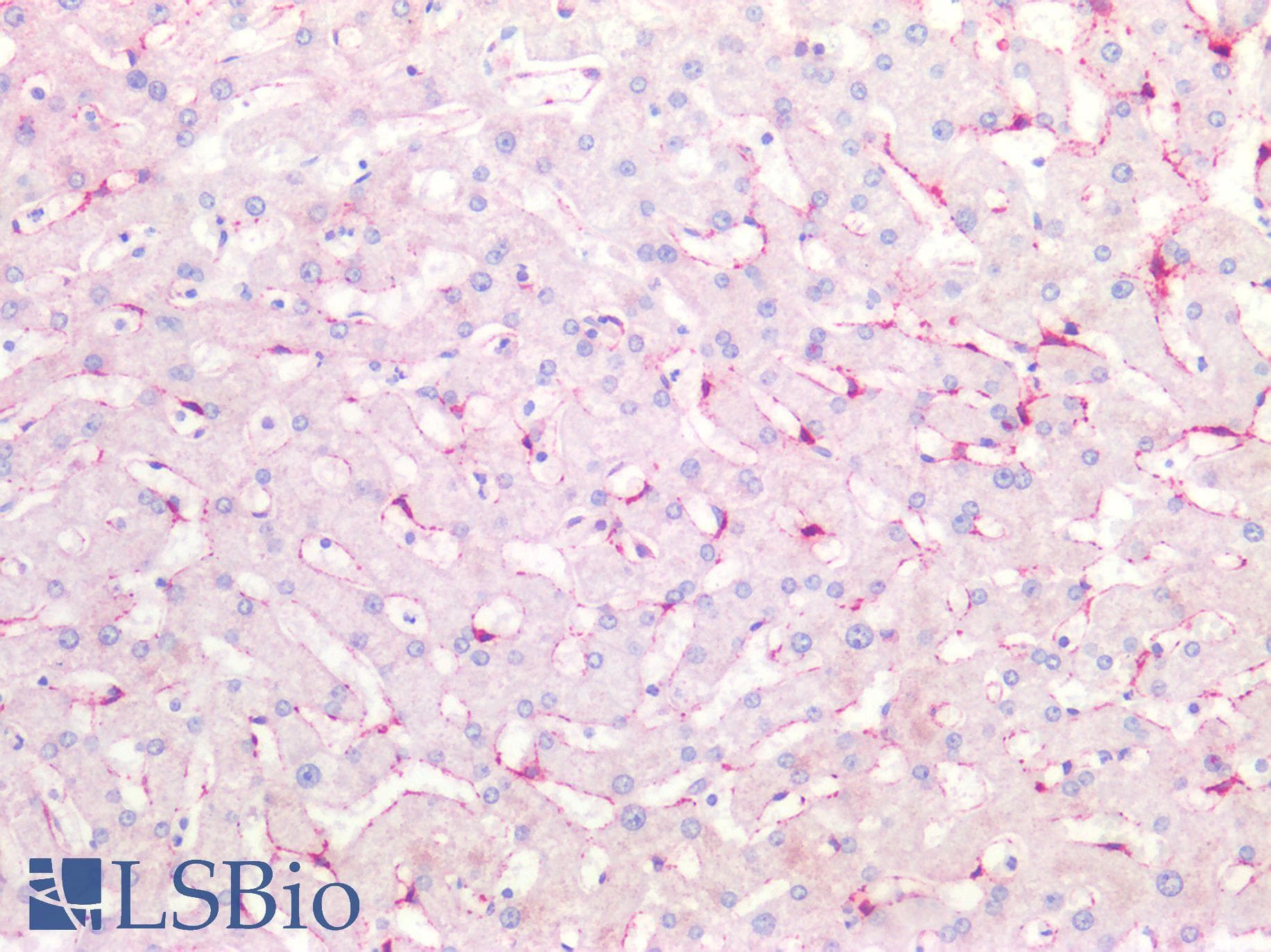 IHC-plus™ CAV1 / Caveolin 1 Antibody