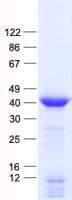 Human ALDOB Protein (Recombinant His, N-Terminal)