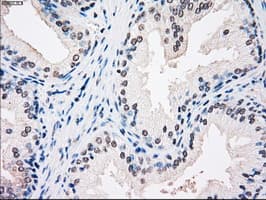 SSB / La Antibody (clone OTI3H9)