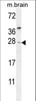 TIMP4 Antibody (aa48-74)