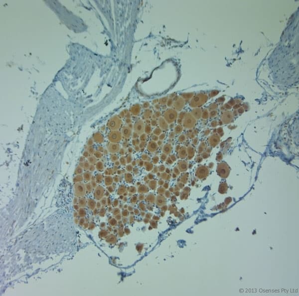 Polyclonal Rabbit anti-Human CLVS1 Antibody (aa300-354, IHC, WB)