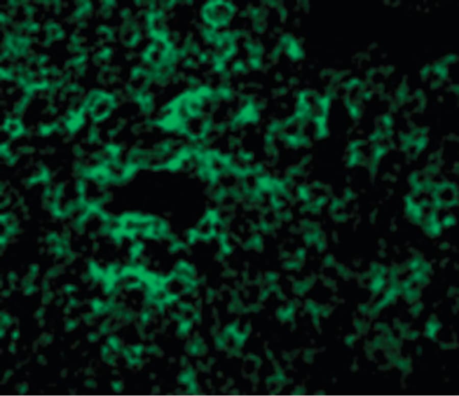 IHC-plus™ MAP3K7 / TAK1 Antibody