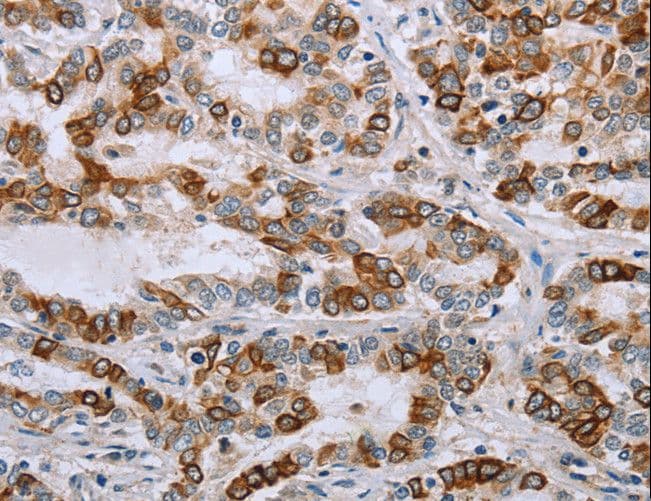 Polyclonal Rabbit anti-Human NMT1 Antibody (IHC)