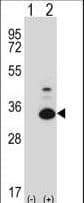 PRPK / TP53RK Antibody (aa100-128)