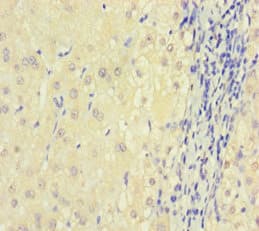 Polyclonal Rabbit anti-Human DGUOK / Deoxyguanosine Kinase Antibody (aa40-277)