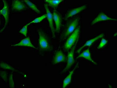 Polyclonal Rabbit anti-Human PPA1 Antibody (IHC)