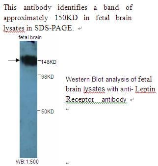 LEPR / Leptin Receptor Antibody