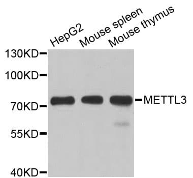 Polyclonal Rabbit anti-Human METTL3 Antibody (IHC, WB)