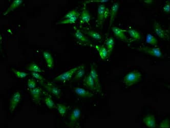 MNK / ATP7A Antibody