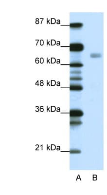Polyclonal Rabbit anti-Human HSF1 Antibody (C-Terminus, IHC, WB)