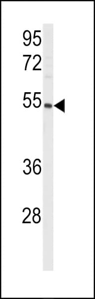 PGIS / PTGIS Antibody (aa30-61)
