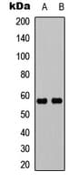 UBXN11 / SOC Antibody (Internal)