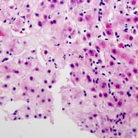 Polyclonal Rabbit anti-Human SERINC2 Antibody (C-Terminus, IHC, WB)