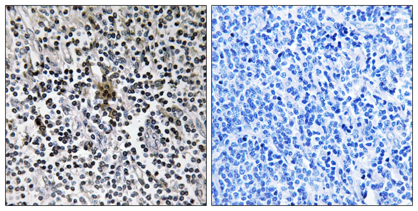 RPS3 / Ribosomal Protein S3 Antibody (aa171-220)