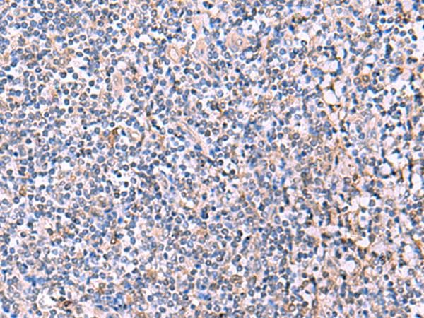 PEPD / PROLIDASE Antibody