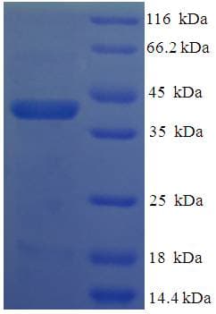 Human VTI1B Protein (Recombinant His-SUMO)