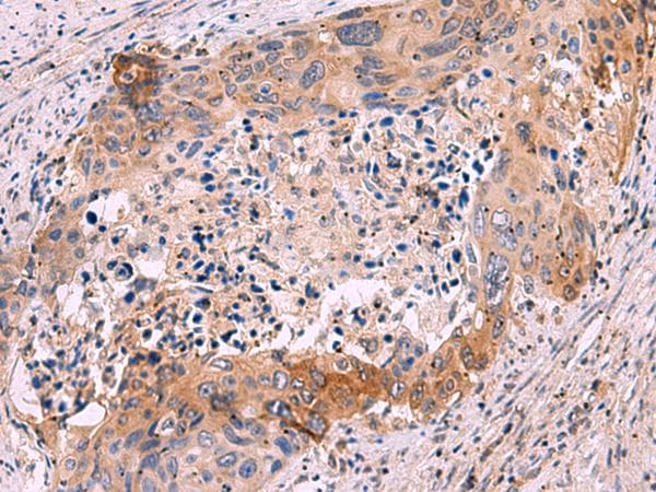 GRIK4 / KA1 Antibody