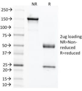 Monoclonal Mouse anti-Human CEA / Carcinoembryonic Antigen Antibody (clone C66/1291, IF)