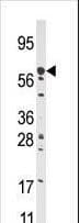 CPT2 Antibody (aa6-38)