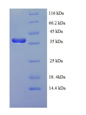 Epstein-Barr Virus BZLF1 Protein (Recombinant His-SUMO)
