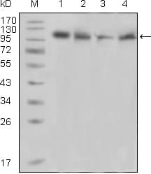 IHC-plus™ PTK2B / PYK2 Antibody (clone 5E2D5)