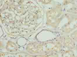 Polyclonal Rabbit anti-Human ZNF274 Antibody (IHC)