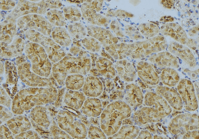 Polyclonal Rabbit anti-Human CLTA / LCA Antibody (IHC, WB)