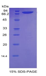 Rat NRP1 / Neuropilin 1 Protein (Recombinant His-MBP)