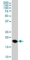 IHC-plus™ Monoclonal Mouse anti-Human UBCH10 / UBE2C Antibody (clone 9D3, IHC, IF, WB)