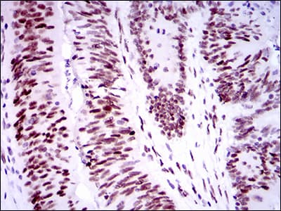 Monoclonal Mouse anti-Human TP53BP1 / 53BP1 Antibody (clone 6B3E10, aa574-773, IHC, WB)