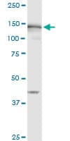 MSH6 Antibody (clone 1F2)