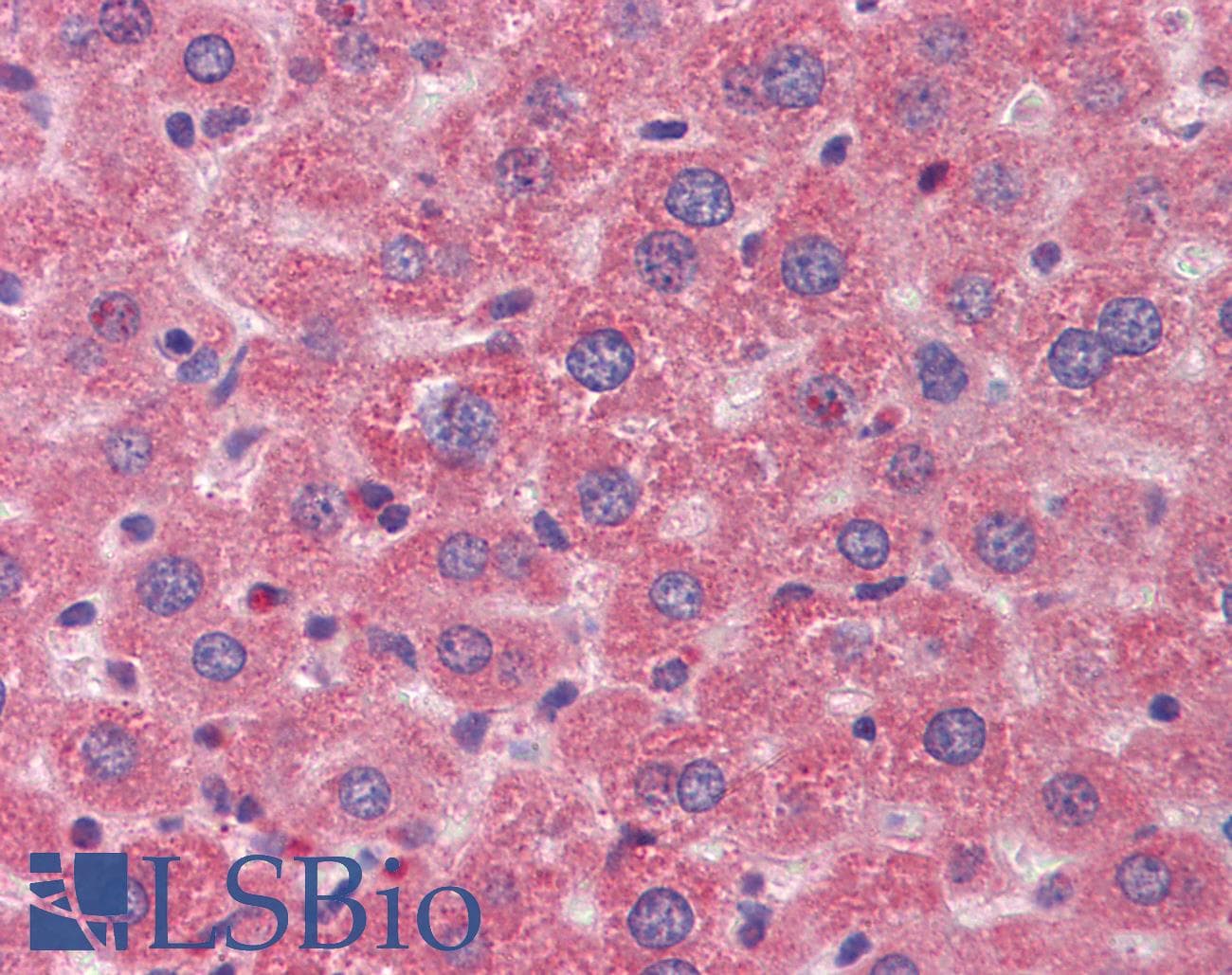 IHC-plus™ Polyclonal Rabbit anti-Mouse ANGPT1 / Angiopoietin-1 Antibody (aa15-45, IHC, WB)