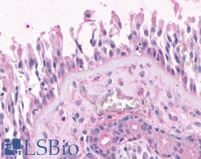 PathPlus™ OR2A4 Antibody (Cytoplasmic Domain)
