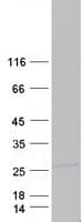 Human HOXC8 Protein (Recombinant Myc-DDK (Flag))