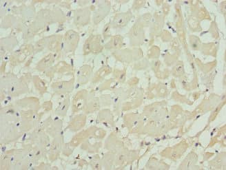 Polyclonal Rabbit anti-Human KCNIP2 / KCHIP2 Antibody (IHC)