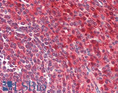Polyclonal Rabbit anti-Human USP12 Antibody (IHC, WB)